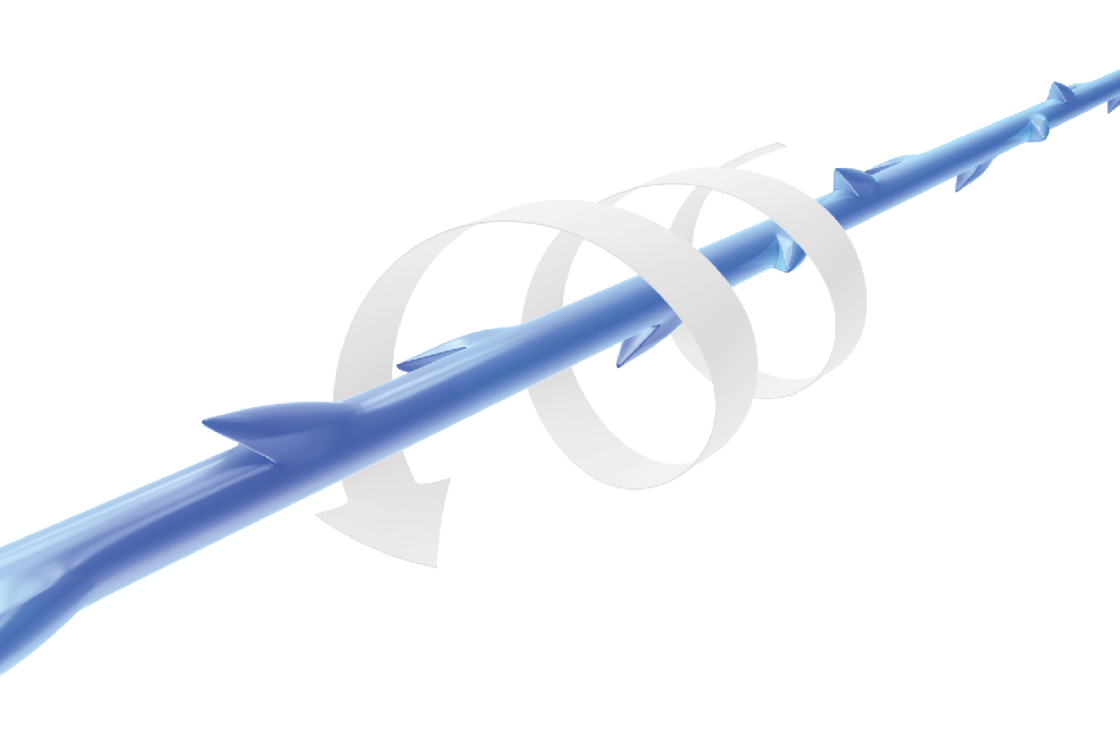 MINT PDO threads Patented 360° 3D helical barbs
